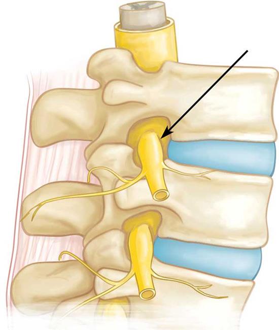 Spinal nerve root