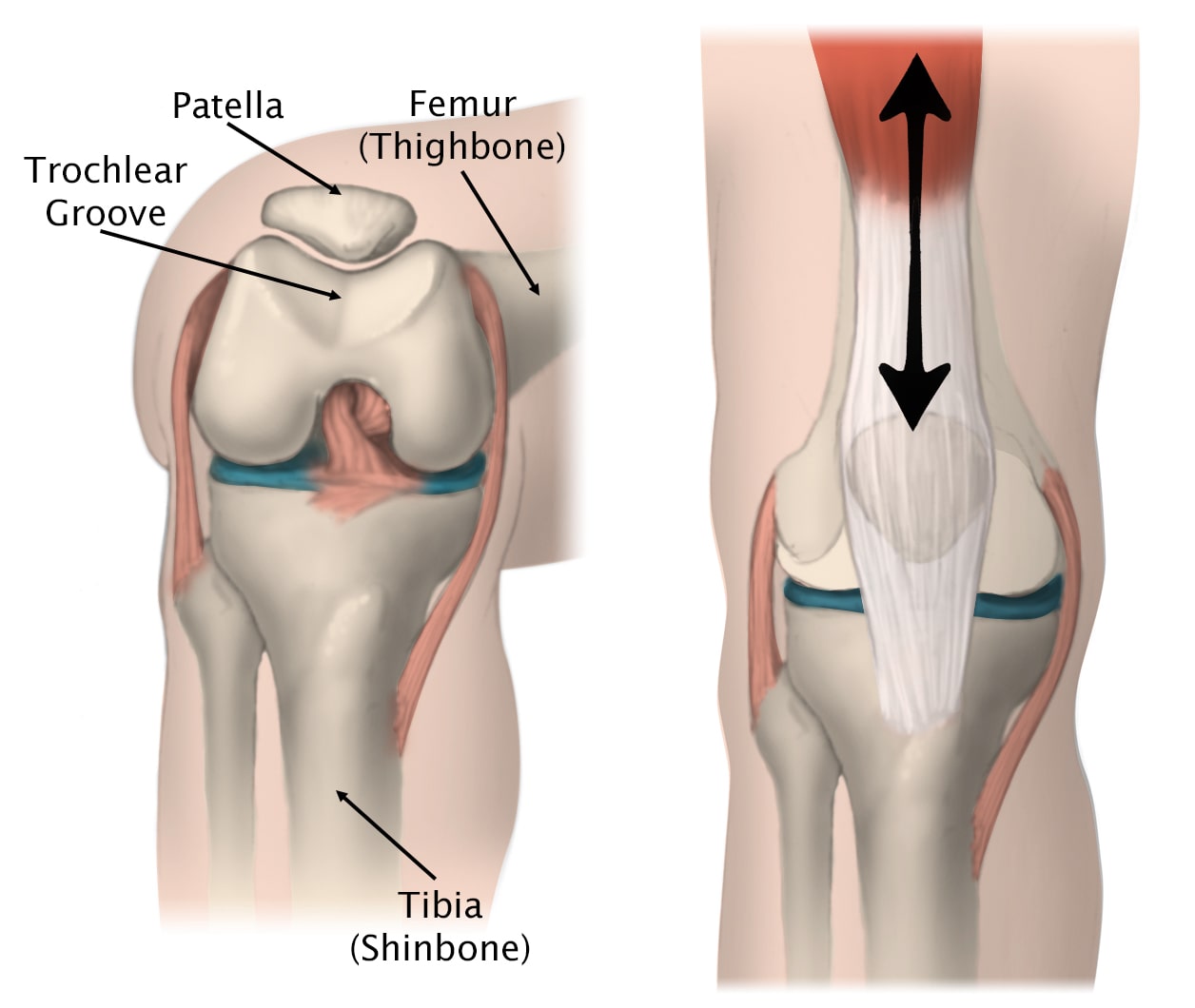 Patella on sale knee problems