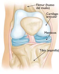 Osteoartritis de rodilla (Knee Osteoarthritis) - OrthoInfo - AAOS