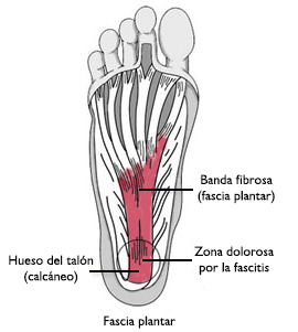 Zapatillas discount fascitis plantar