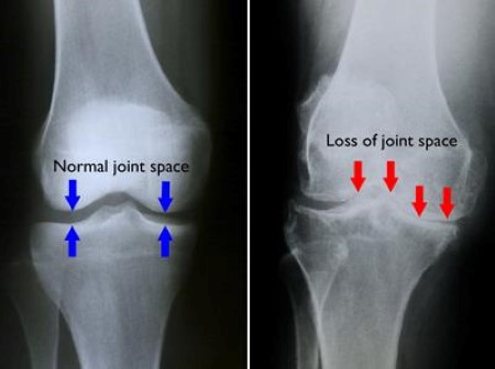 RICPIND KneeSoothe ThermalTherapy Brace - Wowelo - Your Smart Online Shop