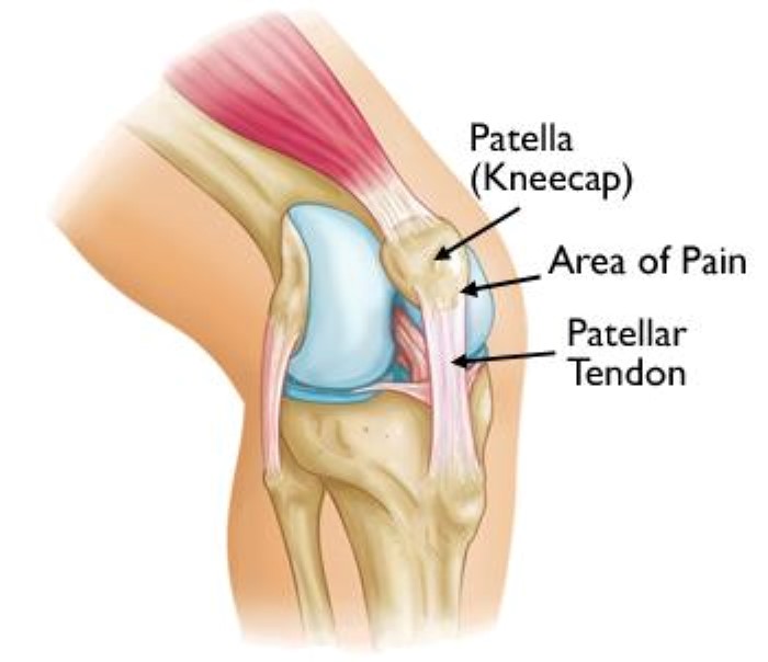 knee anatomy and Jumper's knee