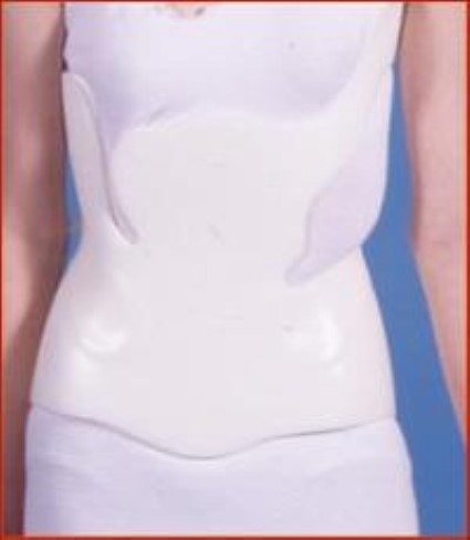 Back Brace for Scoliosis: Options & Effectiveness of Braces