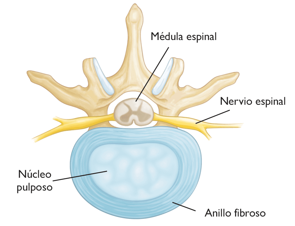 Dolor cervical - Trastornos de los huesos, articulaciones y músculos -  Manual MSD versión para público general