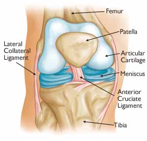 Arthritis: An Overview - OrthoInfo - AAOS