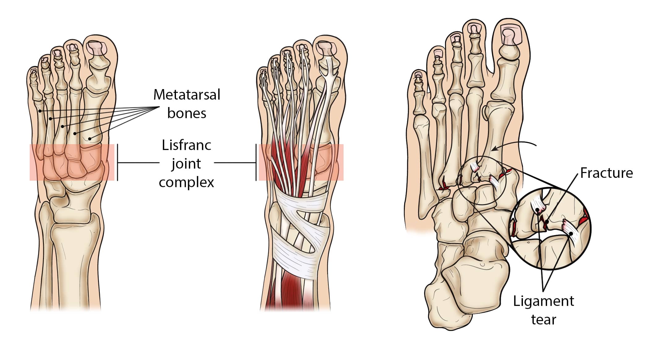 tarsometatarsal joint ligaments