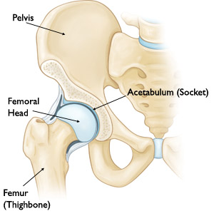 Arthritis: An Overview - OrthoInfo - AAOS