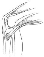 Location of pain from pes anserine bursitis