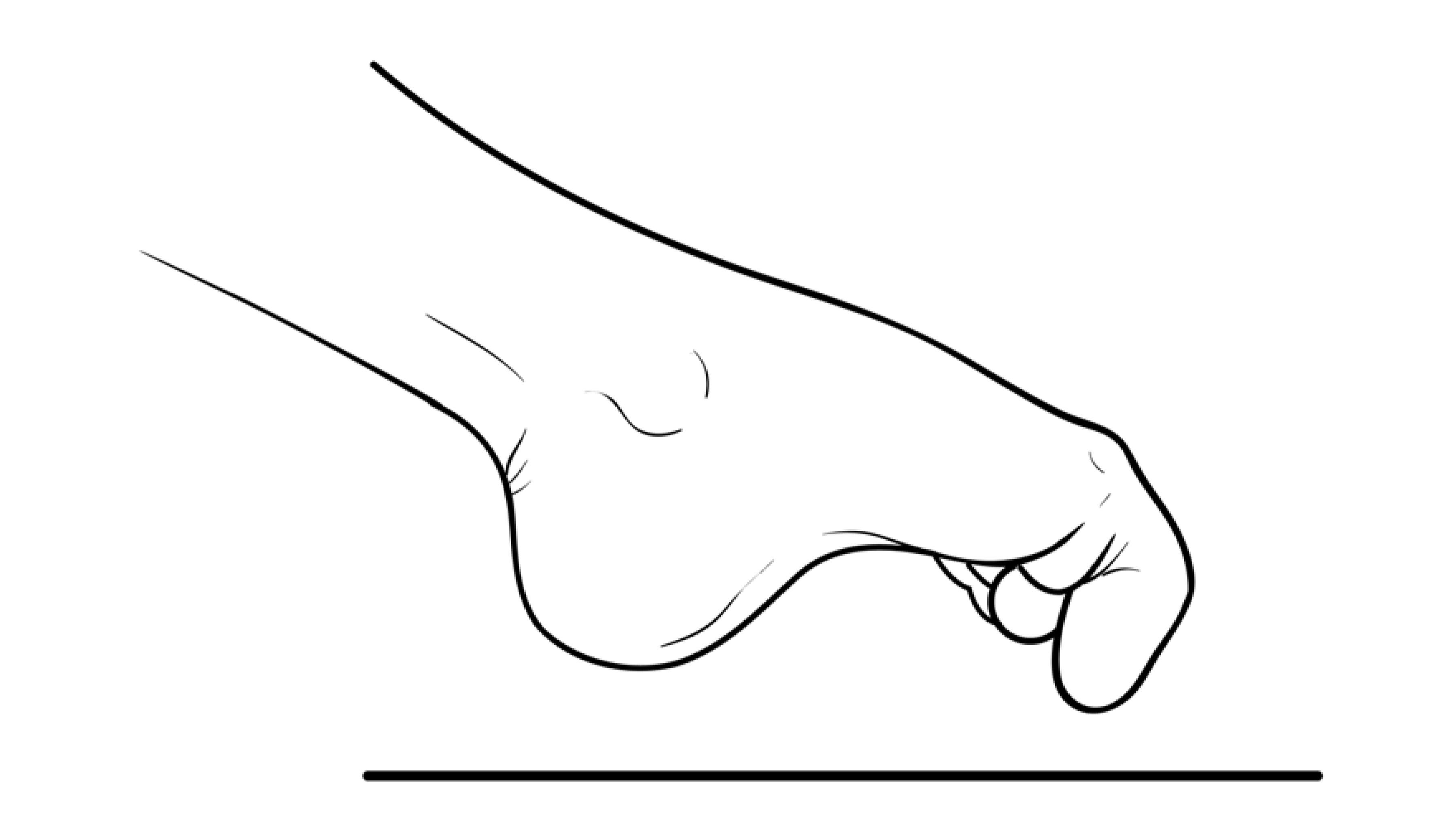 Foot and Ankle Conditioning Program - OrthoInfo - AAOS