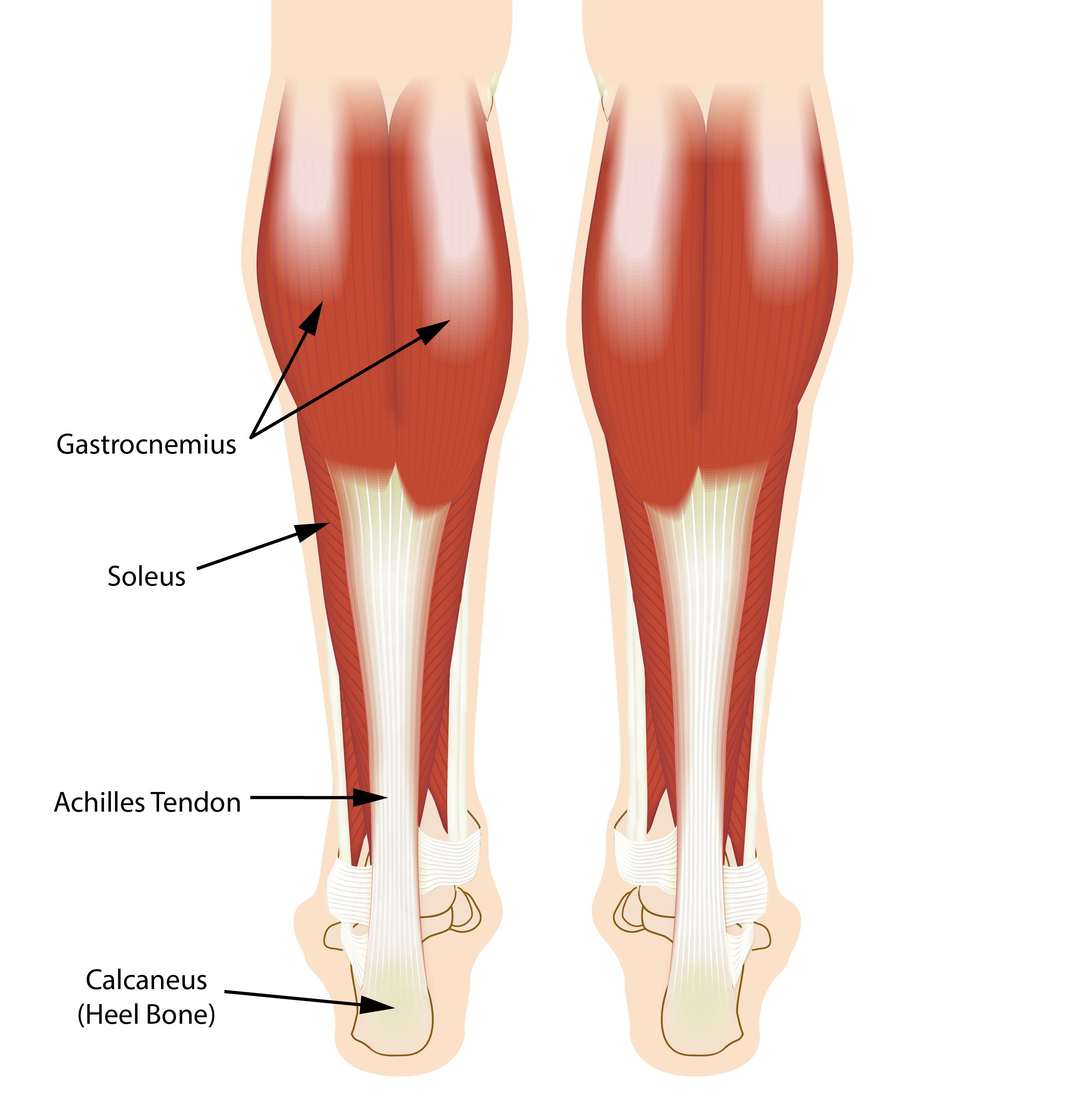 Isolated gastrocnemius tightness: impact on foot diseases