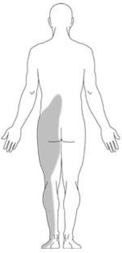 Location of back pain from spinal steonosis