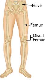 Normal leg anatomy