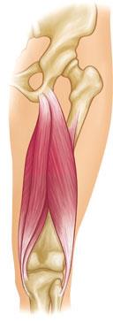 leg muscle strain