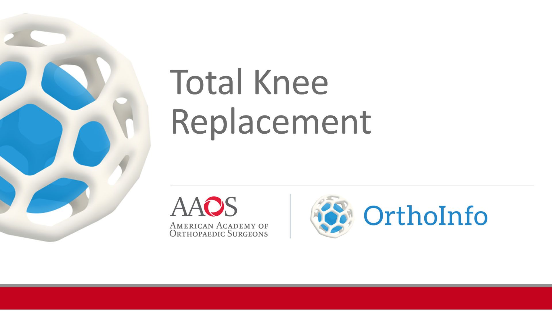 Total Knee Replacement Surgical Video OrthoInfo AAOS