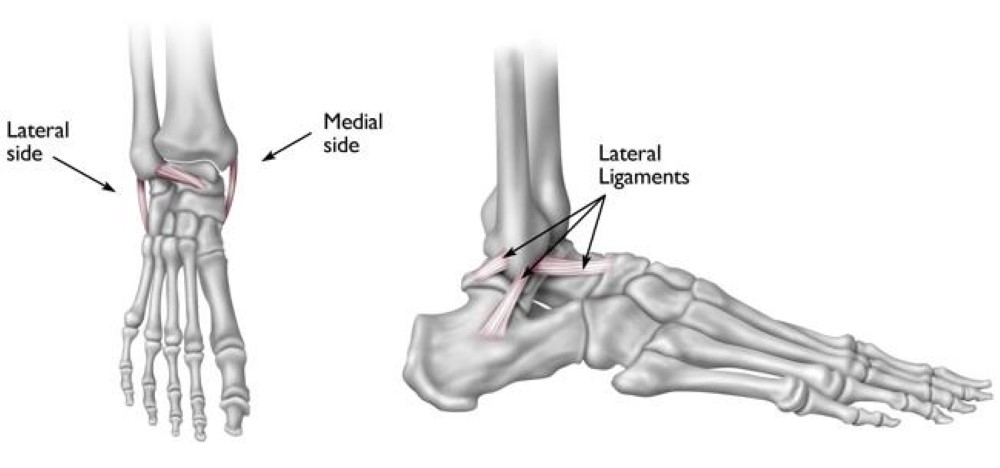 Sprained Ankle Orthoinfo Aaos