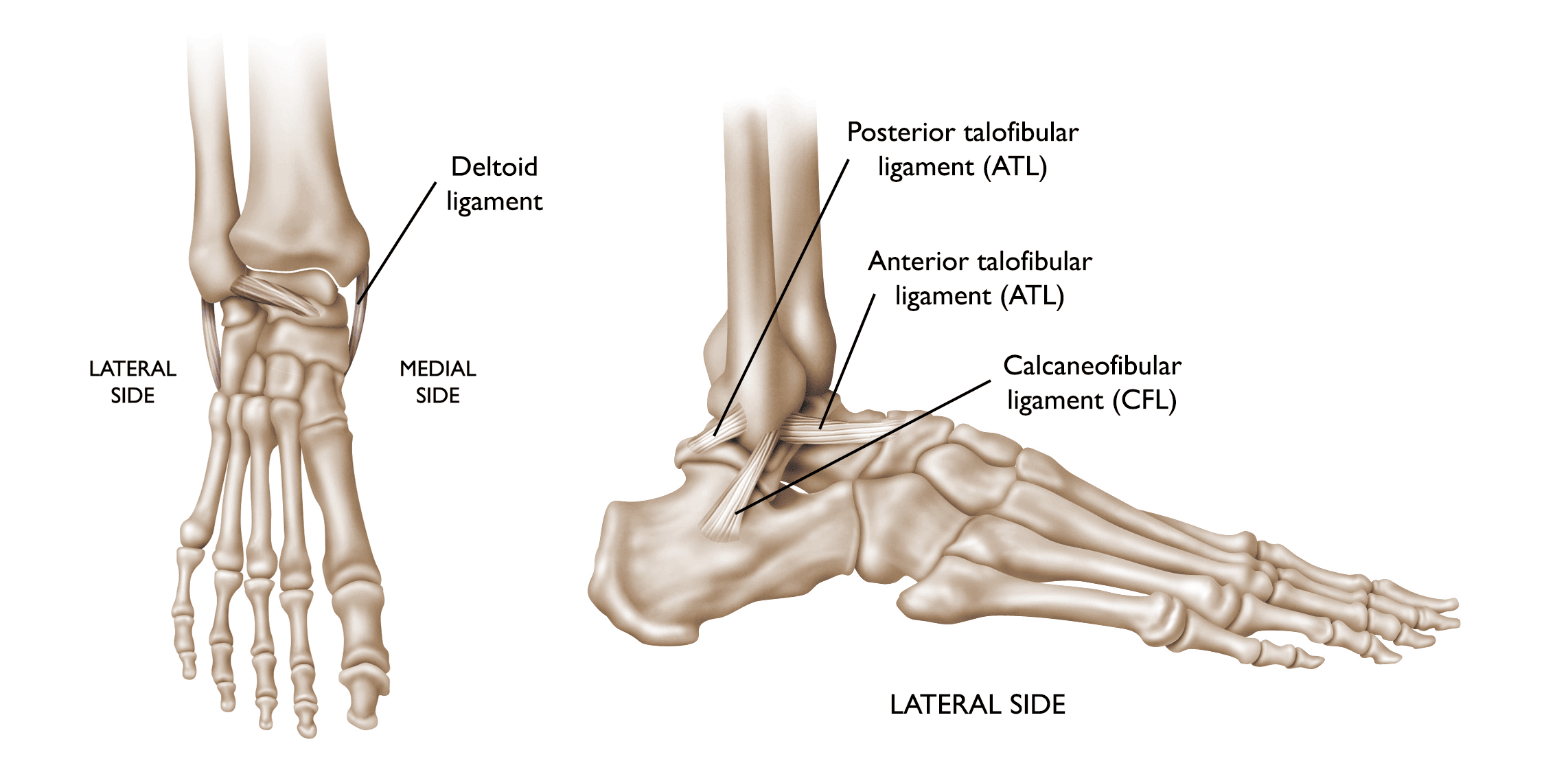 Ankle Sprain Grades and Corresponding Treatments: LA Orthopaedic