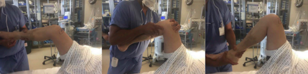 Manipulation Under Anesthesia