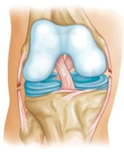 collateral ligament tears
