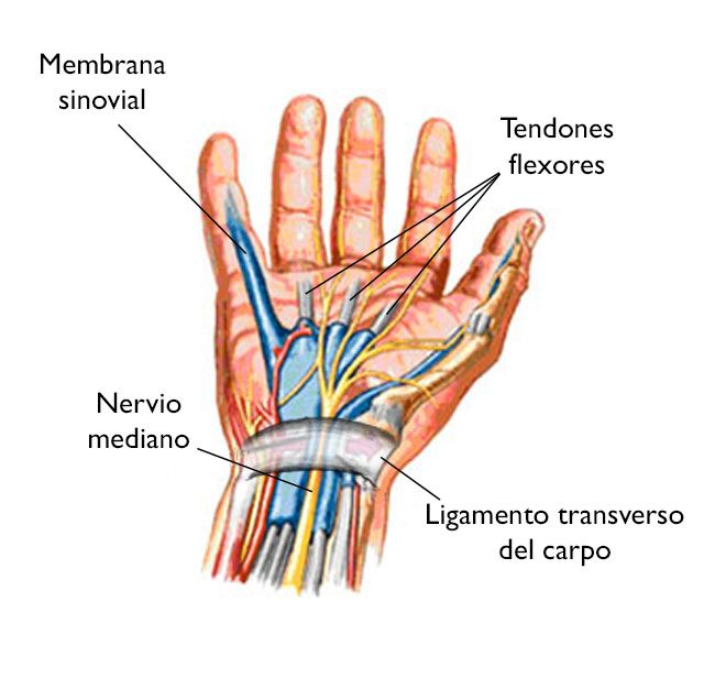 tendones flexores de la muñeca