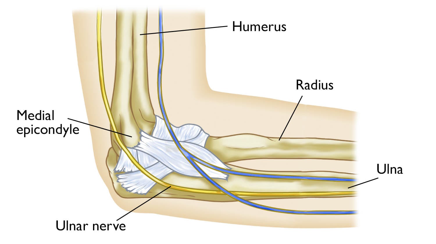Ulnar Nerve Entrapment at the Elbow (Cubital Tunnel Syndrome) - OrthoInfo -  AAOS